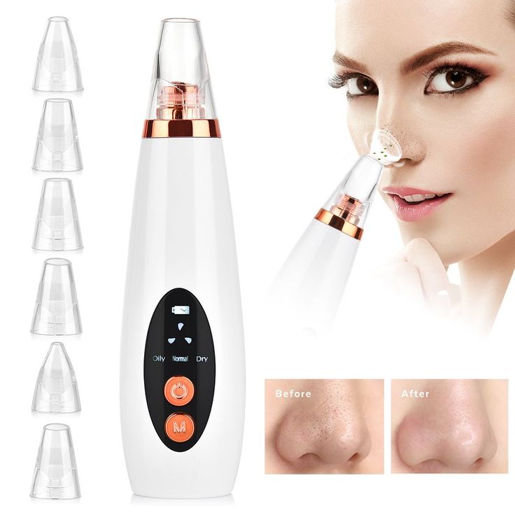 3-in-1 Wireless Blackhead Remover Vacuum | Face & Nose Pore Cleaner