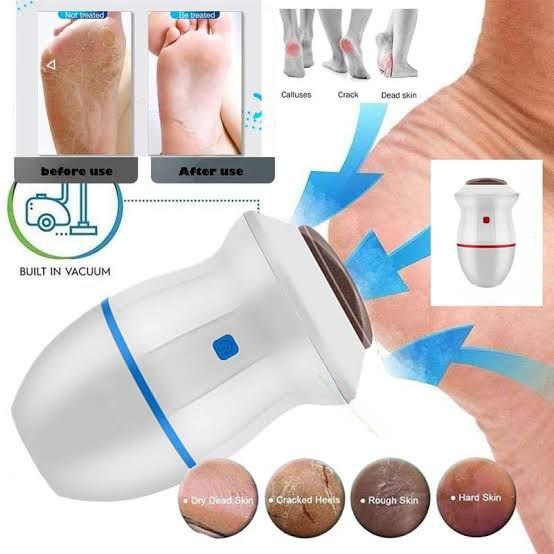 Electric Back Callus Remover