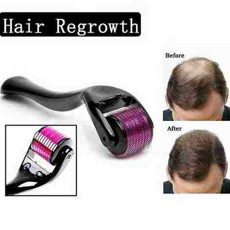 Derma Roller, for Hair and Skin care