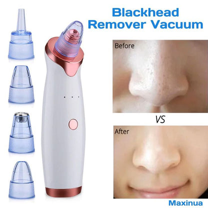 3-in-1 Wireless Blackhead Remover Vacuum | Face & Nose Pore Cleaner