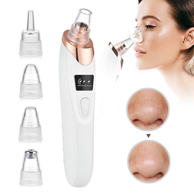3-in-1 Wireless Blackhead Remover Vacuum | Face & Nose Pore Cleaner