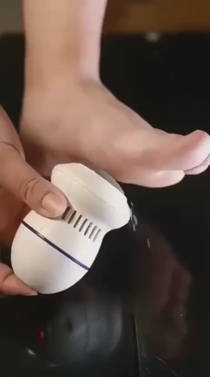 Electric Back Callus Remover
